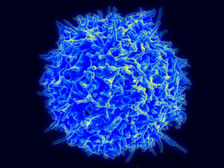 Электронная микрофотография иммунной Т-клетки ((фото Wikimedia Commons). )