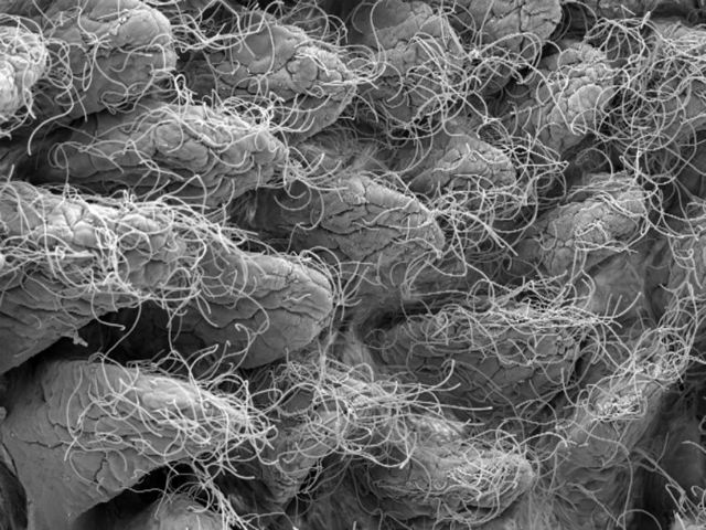 Кишечные бактерии мыши с обретённой непереносимостью глюкозы (фото Weizmann Institute of Science).
