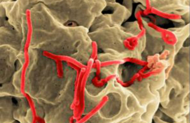 Вирус Эбола, выделенный красным, распространяется по заражённой клетке (фото National Institutes Of Health/NIAID/SPL). 