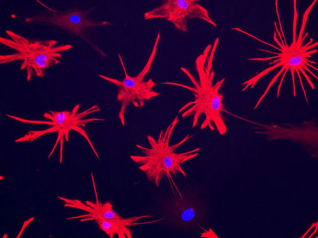 Человеческие астроциты в мозге мышей после пересадки глиальных клеток (фото Steven Goldman/University of Rochester).