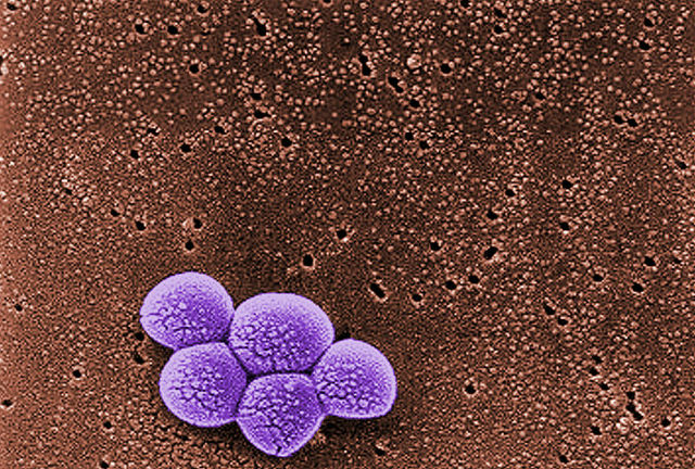 Метициллин-резистентный золотистый стафилококк устойчив к антибиотикам и вызывает массу сложных для лечения заболеваний (фото Wikimedia Commons).