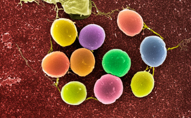 Золотистый стафилококк — болезнетворная бактерия — оказалась хранителем ключа к улучшению технологии редактирования генома (иллюстрация SPL). 