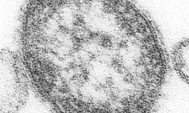 Электронная микрофотография вируса кори (фото CDC/Cynthia S. Goldsmith). 
