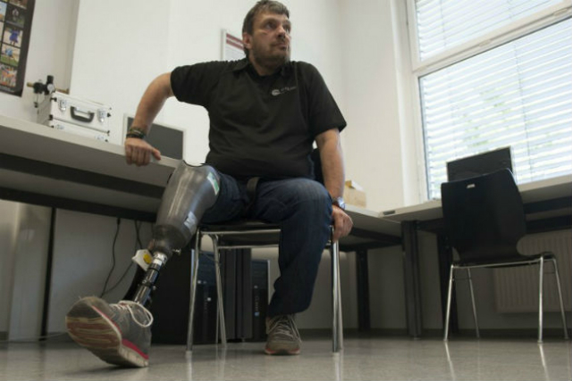 "Чувствующий" протез поможет справиться с явлением фантомных болей (фото FH OOE).