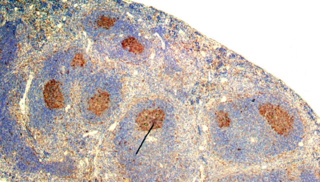 Селезёнка мыши с активными В-лимфоцитами (коричневые), которые производят антитела (фото Cornell University/Singh lab).
