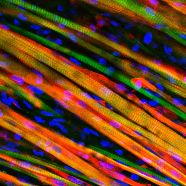 Нити мышечного волокна были окрашены флуоресцентными веществами в яркие цвета, для того чтобы было легче следить за их ростом после имплантации в организм мыши (фото Duke University).