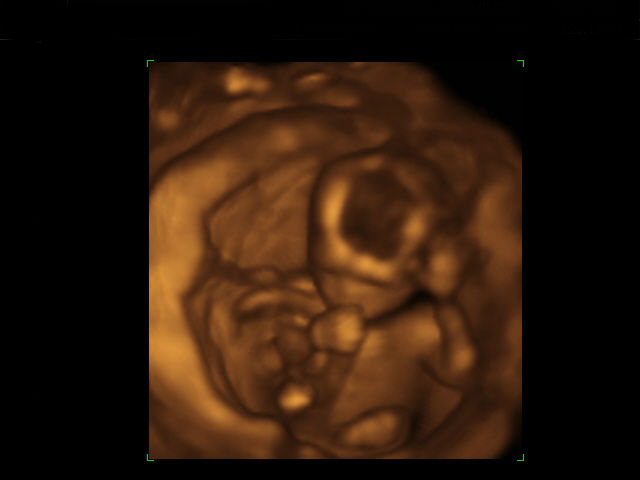 Иногда даже в утробе матери плод тянет свои руки ко рту (фото Wikimedia Commons).