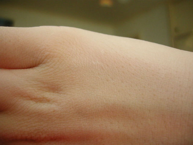 Человеческая кожа обладает обонятельными рецепторами, участвующими в процессе залечивания ран (фото Wikimedia Commons). 